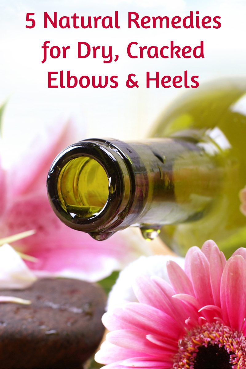 natural remedies for dry cracked feet